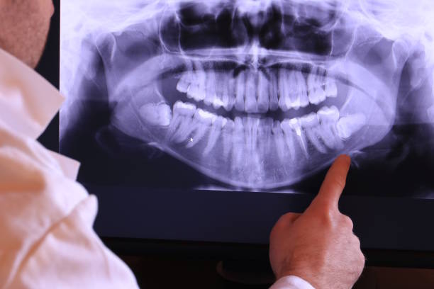 Best Emergency Denture Repair in Martindale, TX